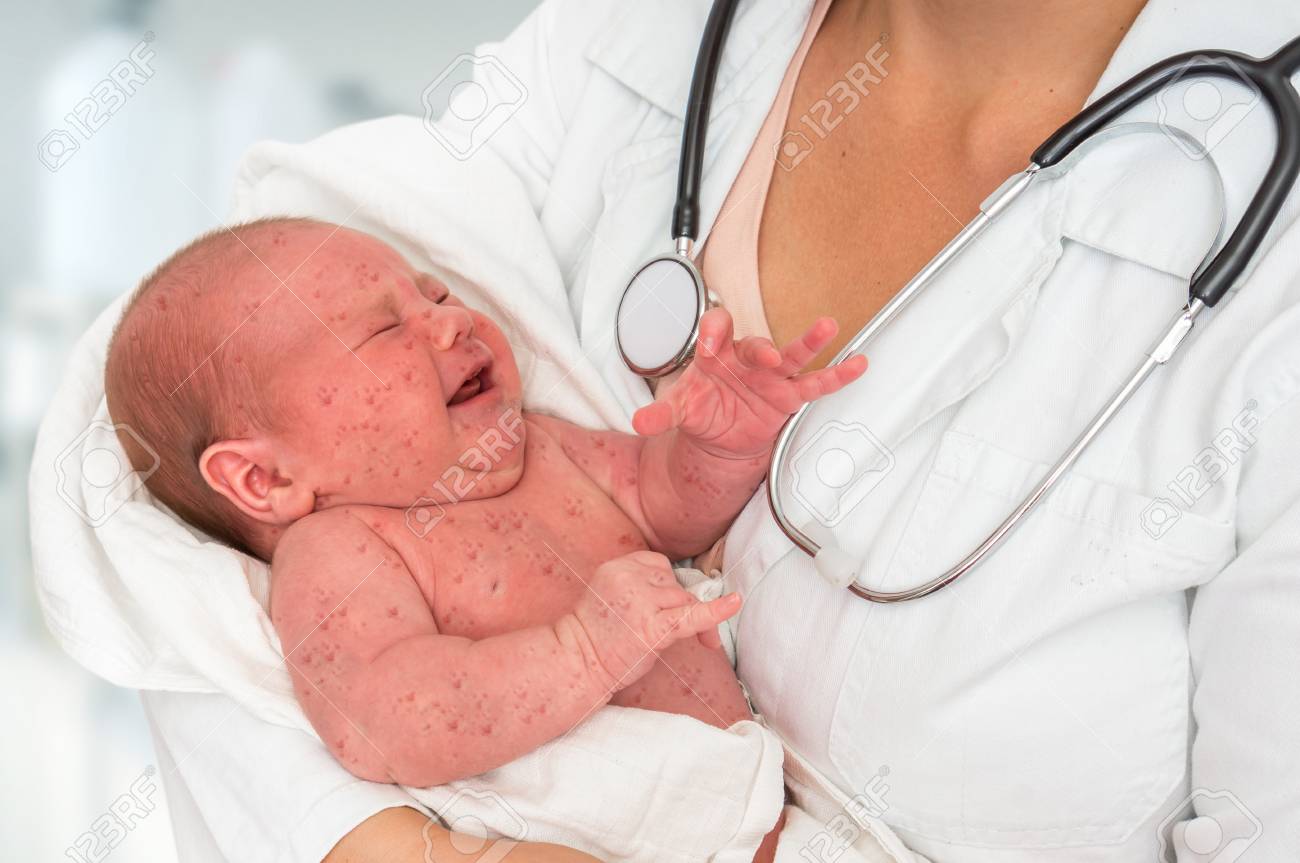 10 Signs That a Newborn Baby Needs to Consult a Doctor